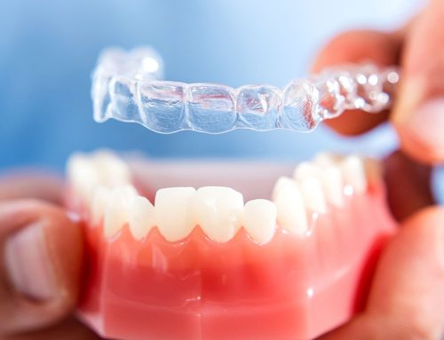 Tecnología Memoflex. Usos y aplicaciones